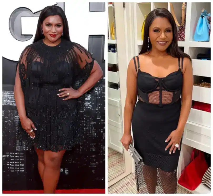 Mindy Kaling Plastic Surgery